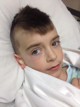 Eardrum reconstruction surgery